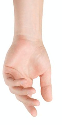 Die Folgen des Zupackens - Arm und Hand Selbsttherapie